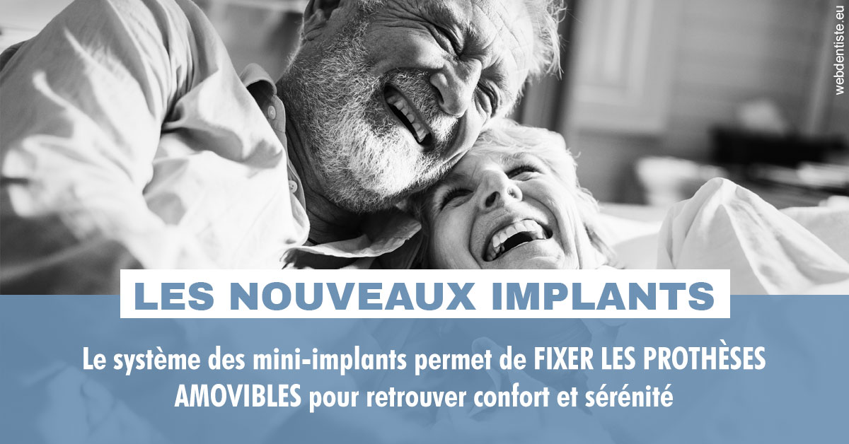 https://www.drs-wang-nief-bogey-orthodontie.fr/Les nouveaux implants 2