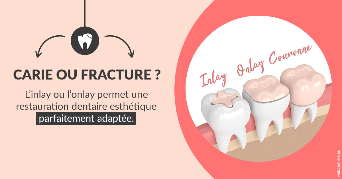 https://www.drs-wang-nief-bogey-orthodontie.fr/T2 2023 - Carie ou fracture 2