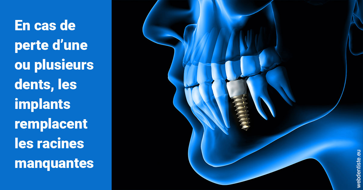 https://www.drs-wang-nief-bogey-orthodontie.fr/Les implants 1