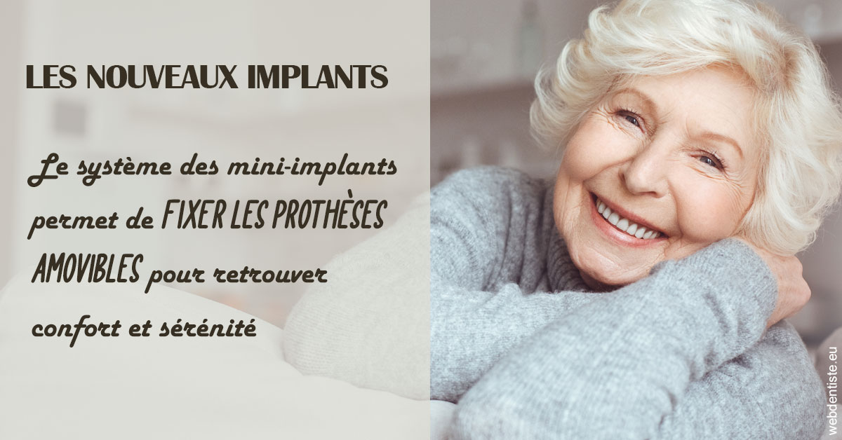 https://www.drs-wang-nief-bogey-orthodontie.fr/Les nouveaux implants 1