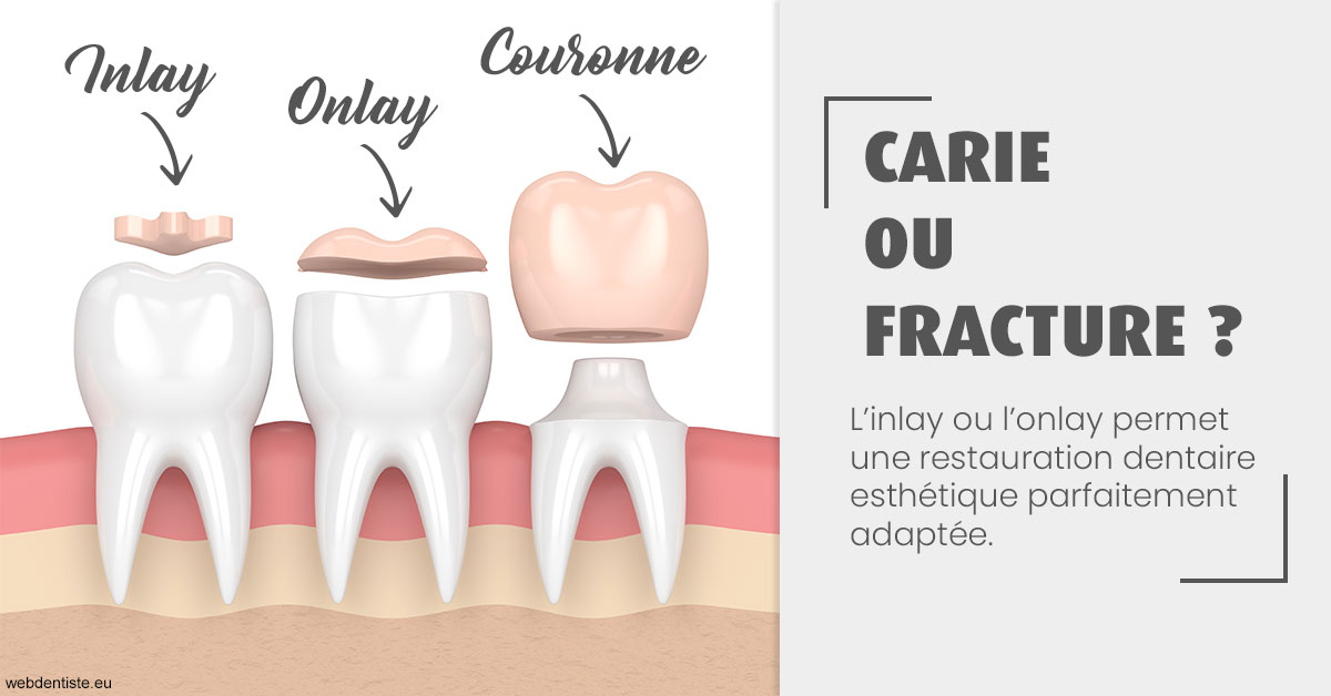 https://www.drs-wang-nief-bogey-orthodontie.fr/T2 2023 - Carie ou fracture 1