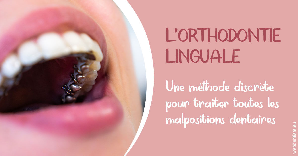 https://www.drs-wang-nief-bogey-orthodontie.fr/L'orthodontie linguale 2
