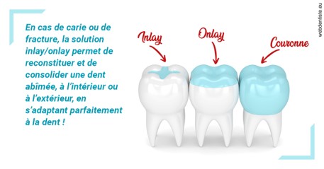 https://www.drs-wang-nief-bogey-orthodontie.fr/L'INLAY ou l'ONLAY