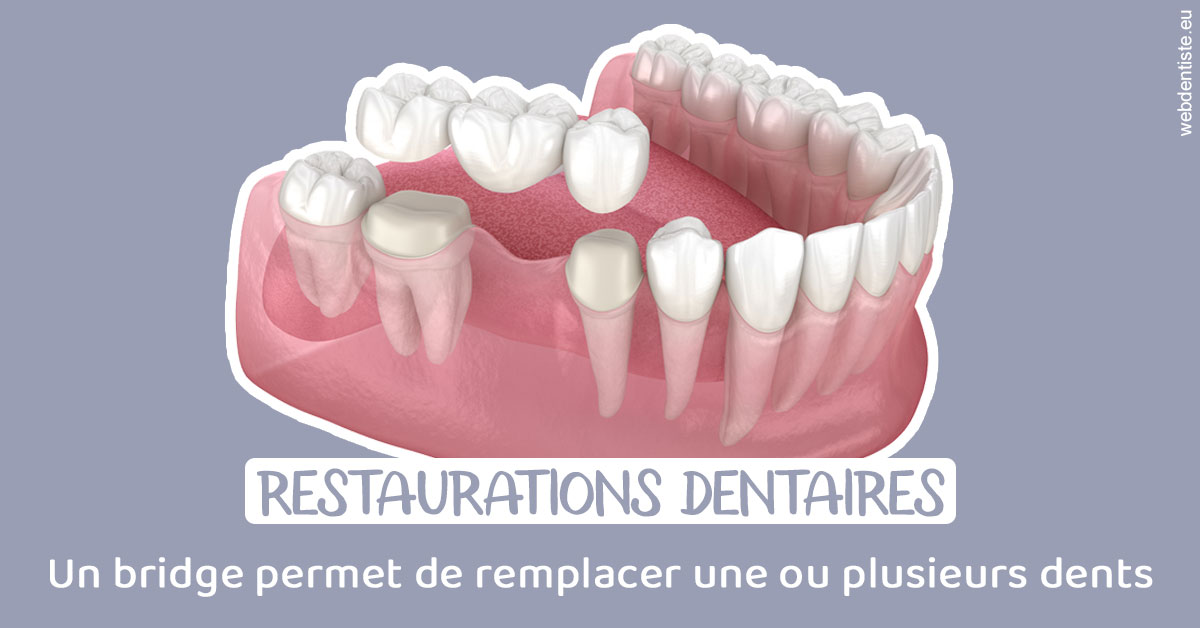 https://www.drs-wang-nief-bogey-orthodontie.fr/Bridge remplacer dents 1