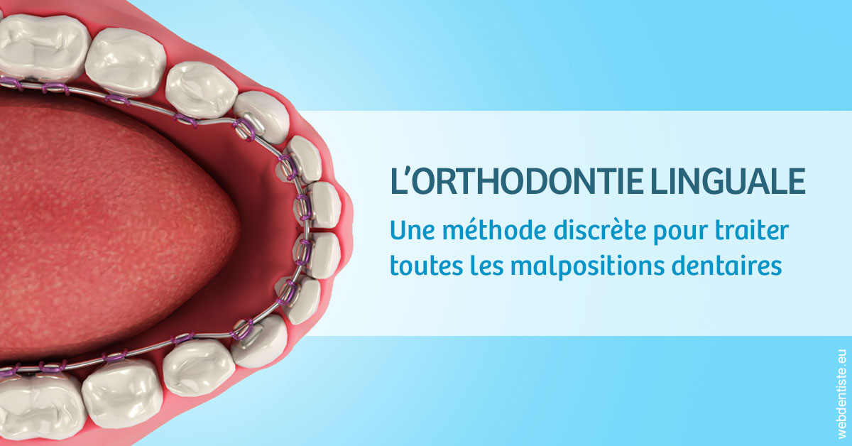 https://www.drs-wang-nief-bogey-orthodontie.fr/L'orthodontie linguale 1