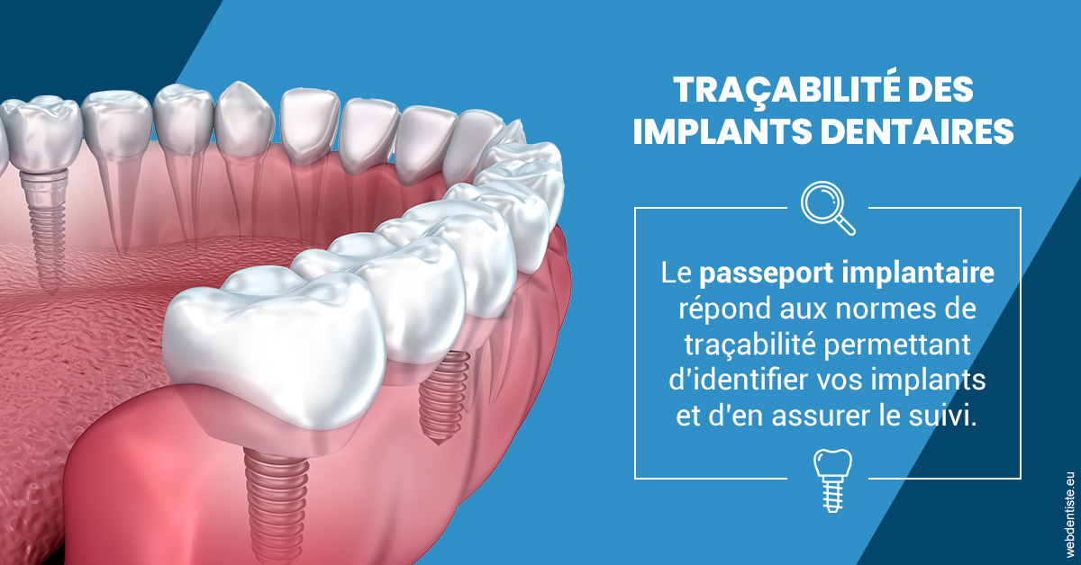 https://www.drs-wang-nief-bogey-orthodontie.fr/T2 2023 - Traçabilité des implants 1