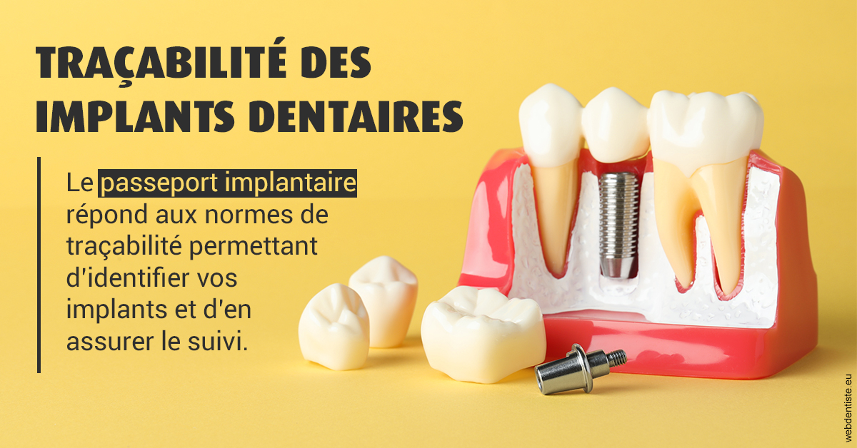 https://www.drs-wang-nief-bogey-orthodontie.fr/T2 2023 - Traçabilité des implants 2
