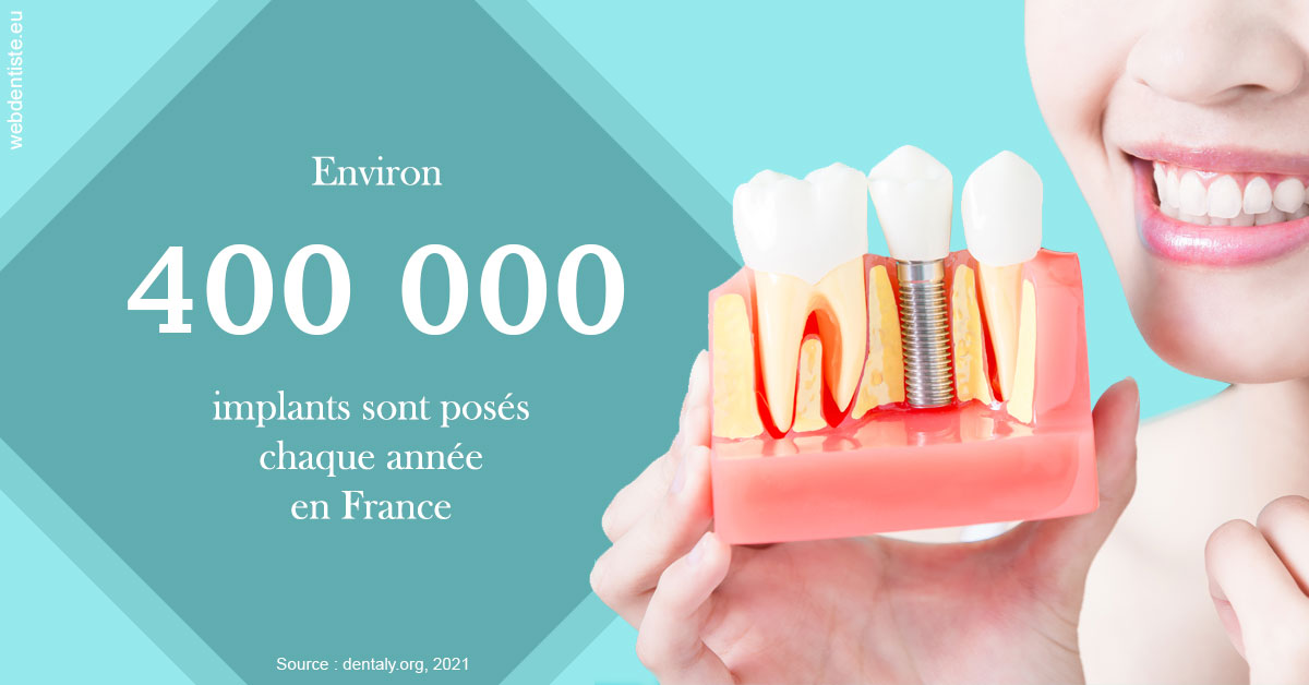 https://www.drs-wang-nief-bogey-orthodontie.fr/Pose d'implants en France 2