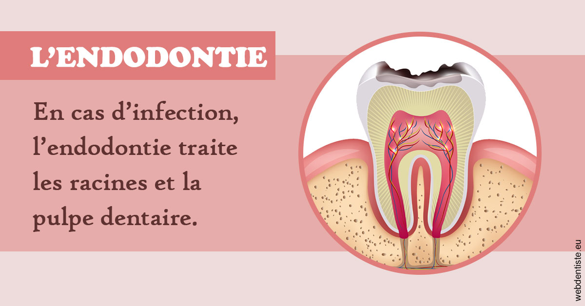 https://www.drs-wang-nief-bogey-orthodontie.fr/L'endodontie 2