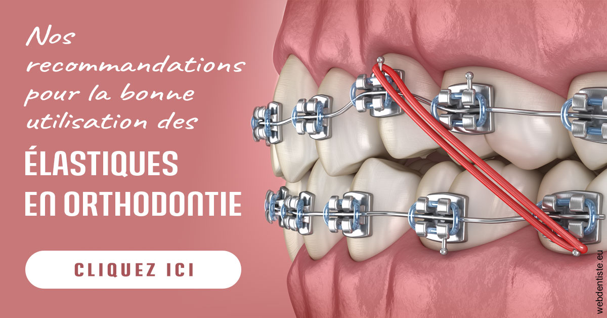 https://www.drs-wang-nief-bogey-orthodontie.fr/Elastiques orthodontie 2